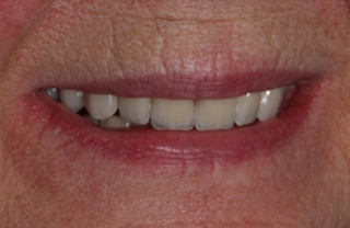 Die Stadtmusikanten - ein Wahrzeichen in Bremen